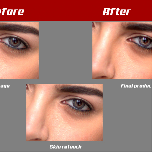 skin retouch (all about)