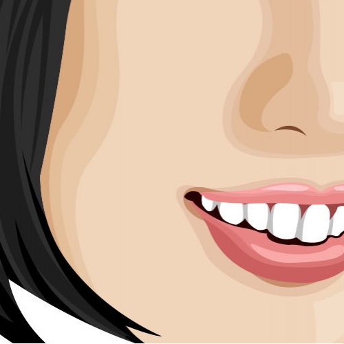 Caricature