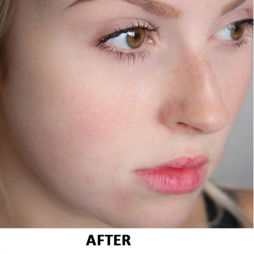 Image Retouch